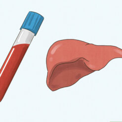 Gamma-glutamyltransferase (GGT)