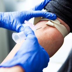 Lactate dehydrogenase