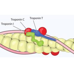 Troponin T